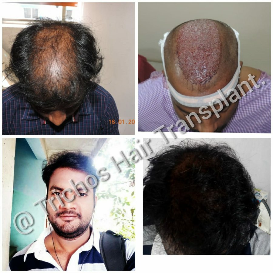 TRICHOS Hair Transplant Institute - TRICHOS Hair Transplant Institute