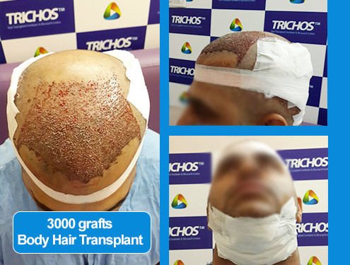 TRICHOS Hair Transplant Institute - TRICHOS Hair Transplant Institute