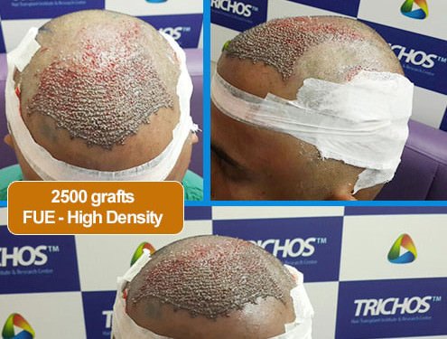 TRICHOS Hair Transplant Institute - TRICHOS Hair Transplant Institute