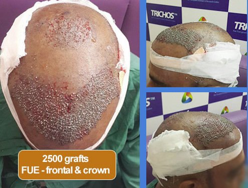 TRICHOS Hair Transplant Institute - TRICHOS Hair Transplant Institute