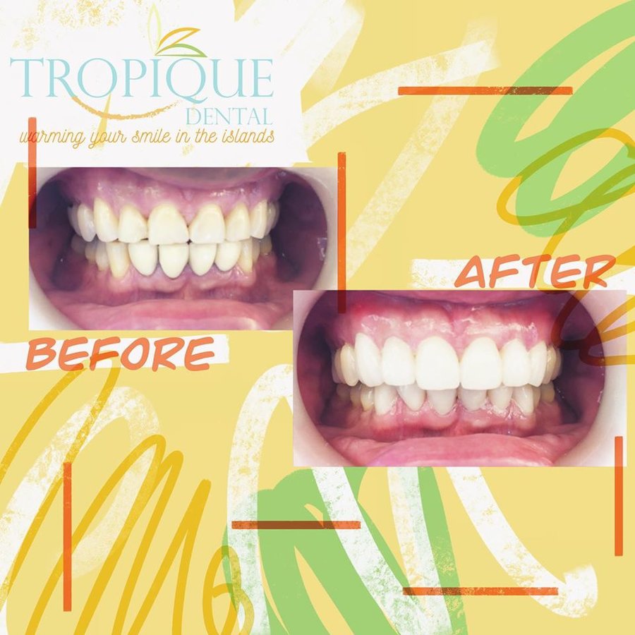 Tropique dental - Tropique dental