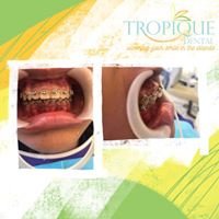 Tropique dental - Tropique dental