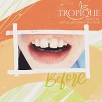 Tropique dental - Tropique dental
