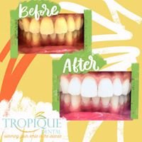 Tropique dental - Tropique dental