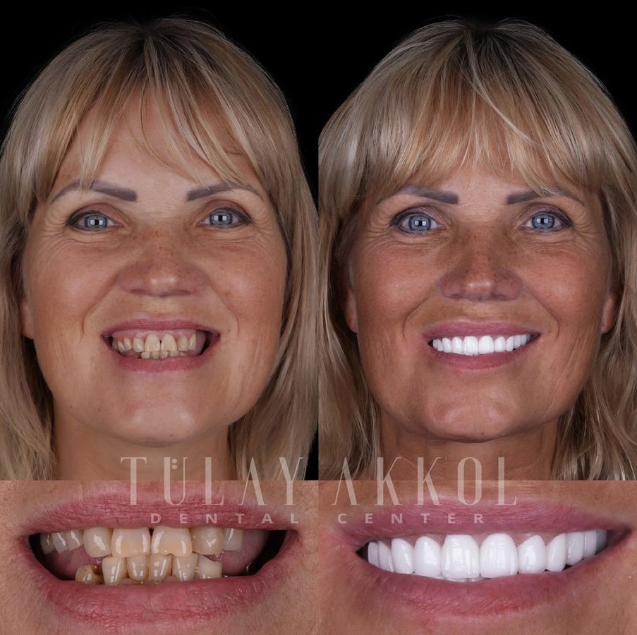 Tülay Akkol Dental Center - Tülay Akkol Dental Center