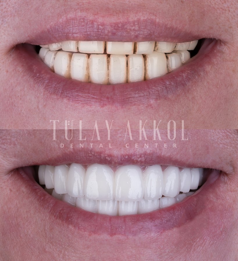 Tülay Akkol Dental Center - Tülay Akkol Dental Center