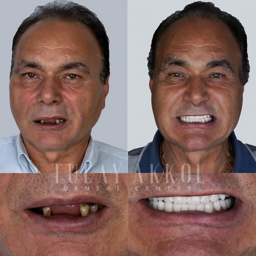 Tülay Akkol Dental Center - Tülay Akkol Dental Center