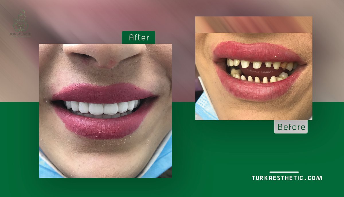 Turk Aestehtic Dentistry - Turk Aestehtic Dentistry