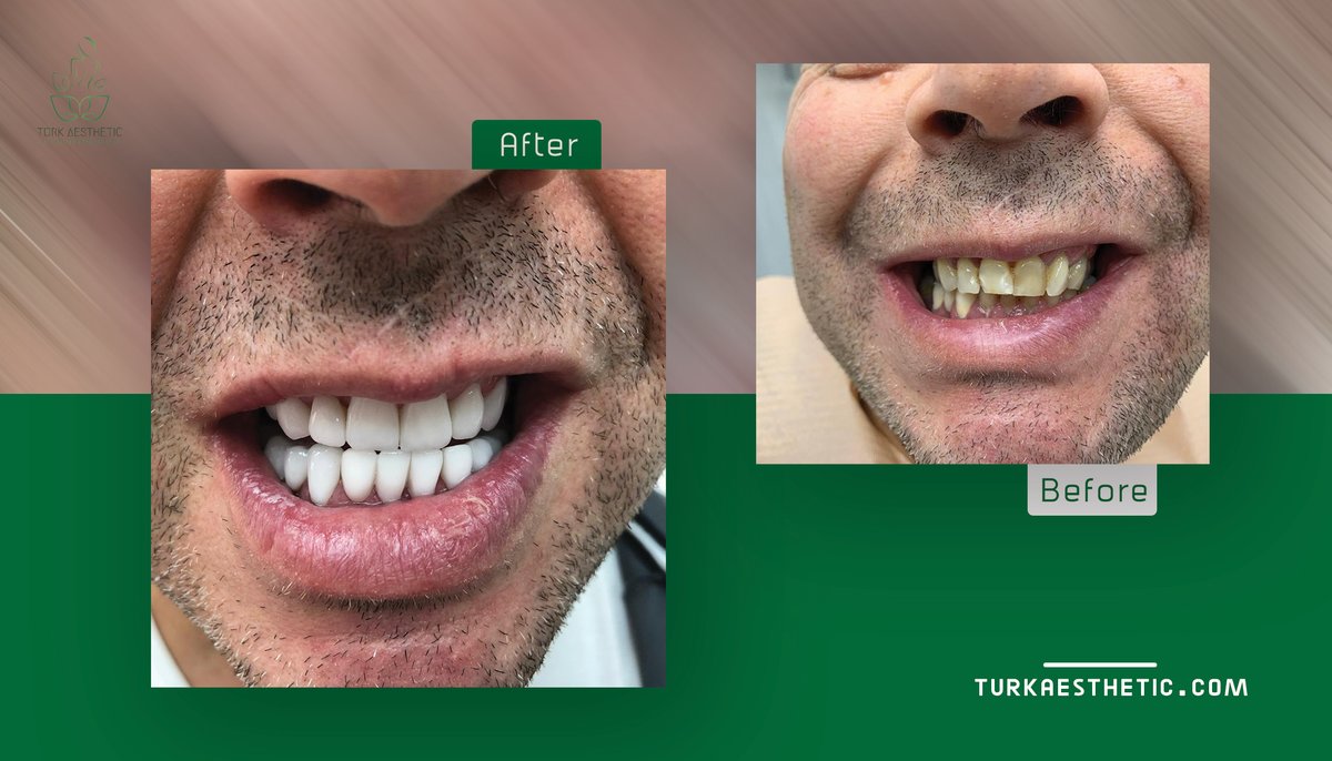 Turk Aestehtic Dentistry - Turk Aestehtic Dentistry