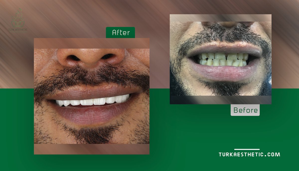 Turk Aestehtic Dentistry - Turk Aestehtic Dentistry