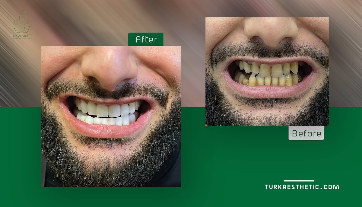 Turk Aestehtic Dentistry - Turk Aestehtic Dentistry