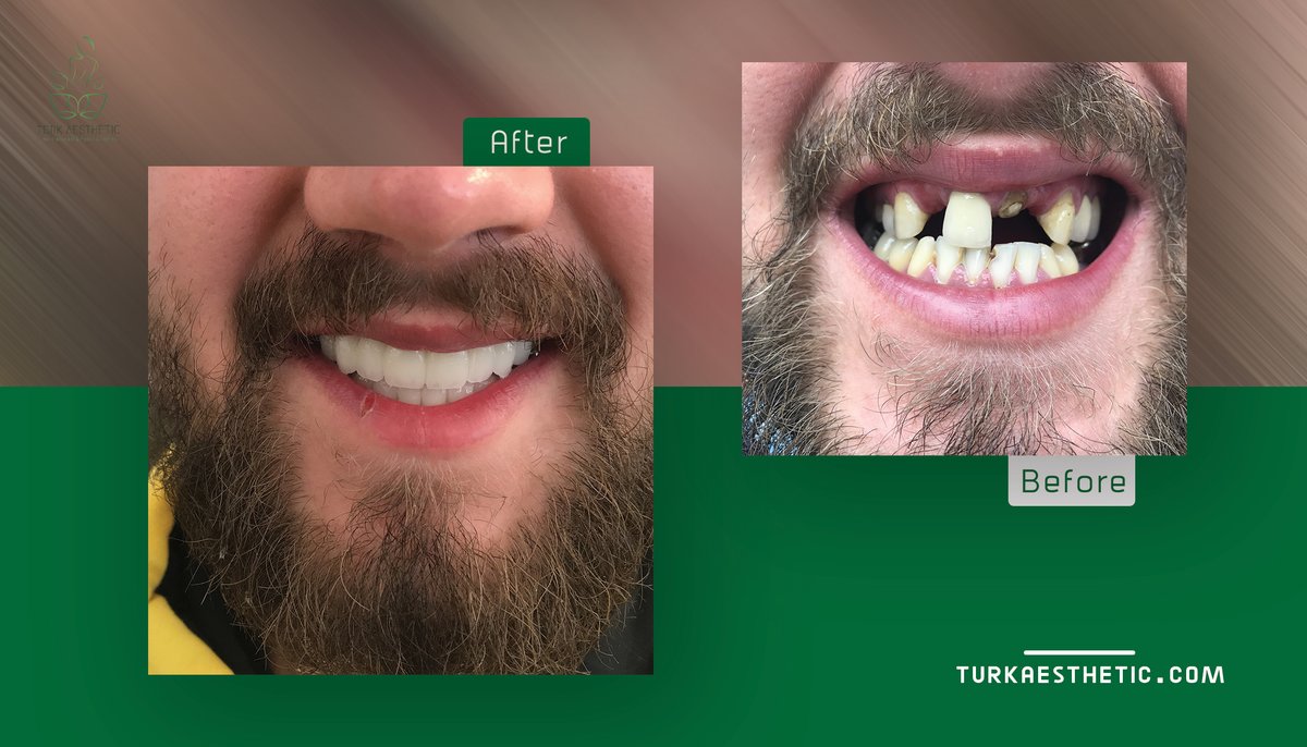 Turk Aestehtic Dentistry - Turk Aestehtic Dentistry