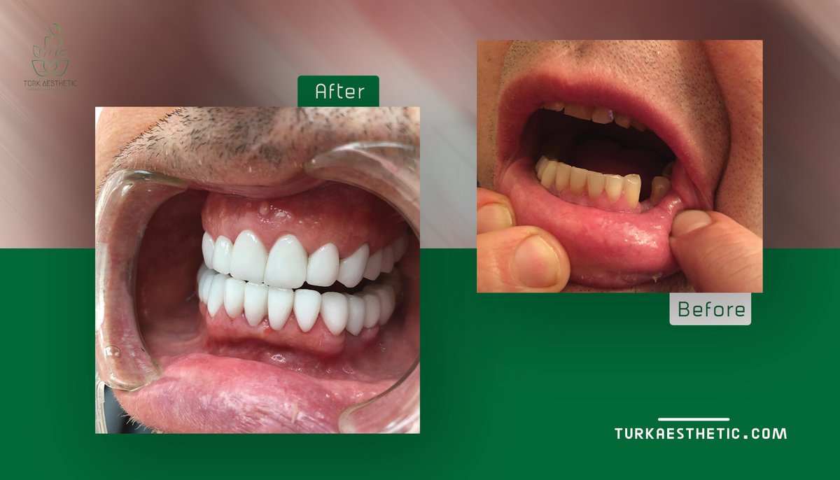 Turk Aestehtic Dentistry - Turk Aestehtic Dentistry