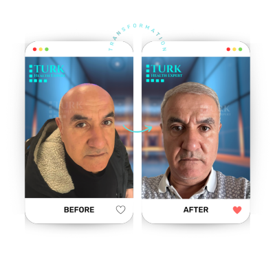 Turk Health Expert - Turk Health Expert