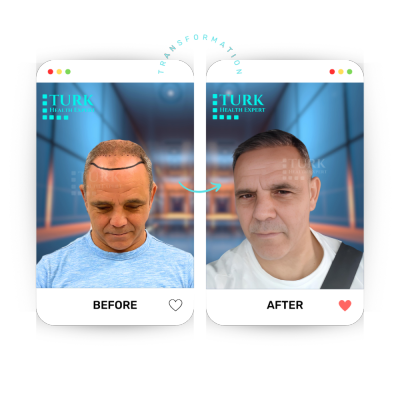 Turk Health Expert - Turk Health Expert