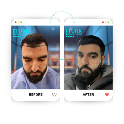 Turk Health Expert - Turk Health Expert