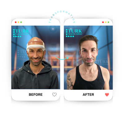 Turk Health Expert - Turk Health Expert