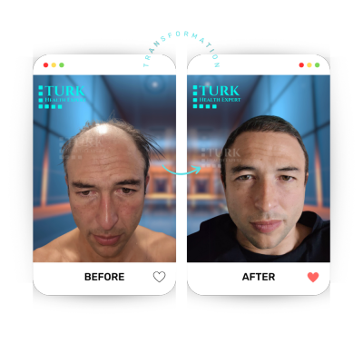 Turk Health Expert - Turk Health Expert