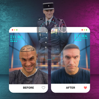 Turk Health Expert - Turk Health Expert