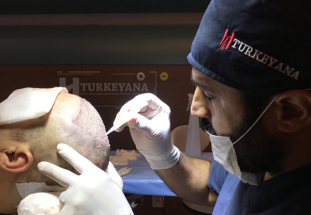 Turkeyana clinic - Hair Transplantation - Turkeyana clinic - Hair Transplantation