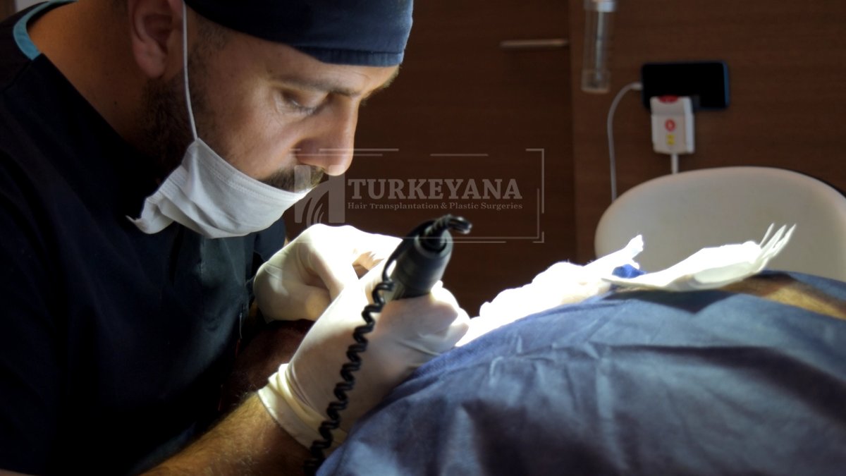 Turkeyana clinic - Hair Transplantation - Turkeyana clinic - Hair Transplantation