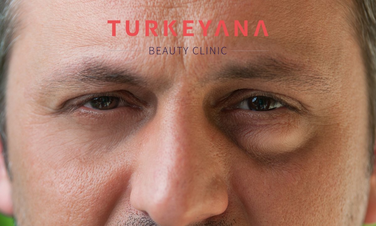 Turkeyana Clinic - Plastic Surgery - Turkeyana Clinic - Plastic Surgery