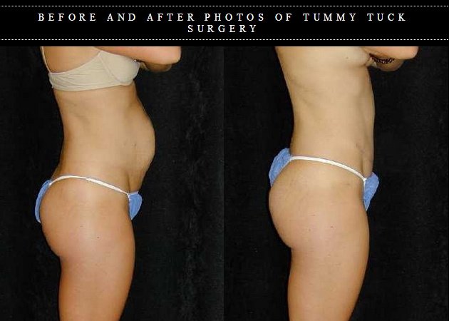 T.Y. Steven Ip, M.D., F.A.C.S. - T.Y. Steven Ip, M.D., F.A.C.S.