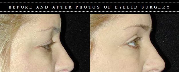 T.Y. Steven Ip, M.D., F.A.C.S. - T.Y. Steven Ip, M.D., F.A.C.S.