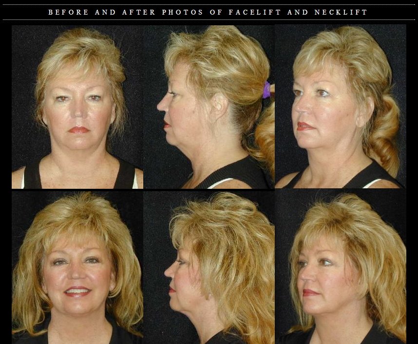 T.Y. Steven Ip, M.D., F.A.C.S. - T.Y. Steven Ip, M.D., F.A.C.S.