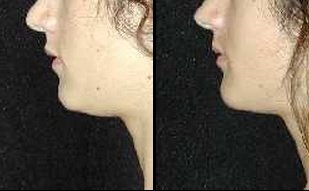 T.Y. Steven Ip, M.D., F.A.C.S. - T.Y. Steven Ip, M.D., F.A.C.S.