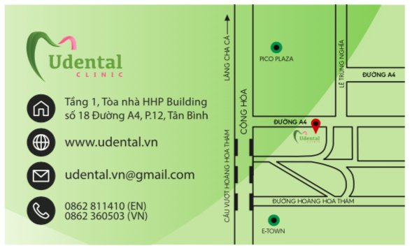 Udental Clinic - English speaking Dentist - Udental Clinic - English speaking Dentist