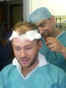 عيادات زراعة الشعر في المملكة المتحدة برايتون - UK Hair Transplant Clinics Brighton