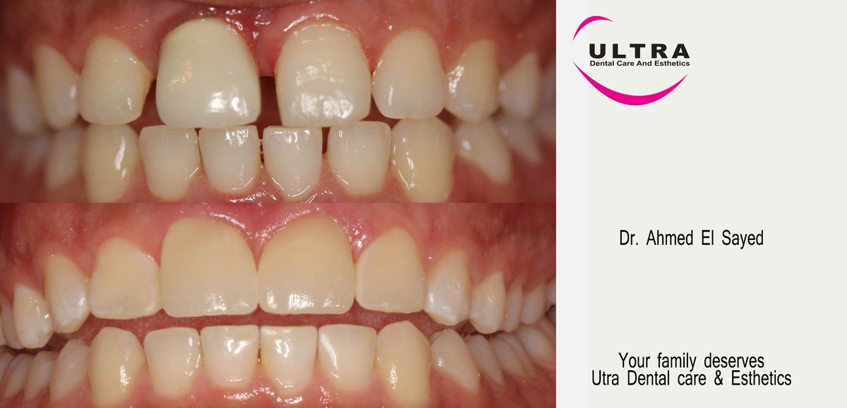 Ultra Dental Care & Esthetic Dental Center - Ultra Dental Care & Esthetic Dental Center