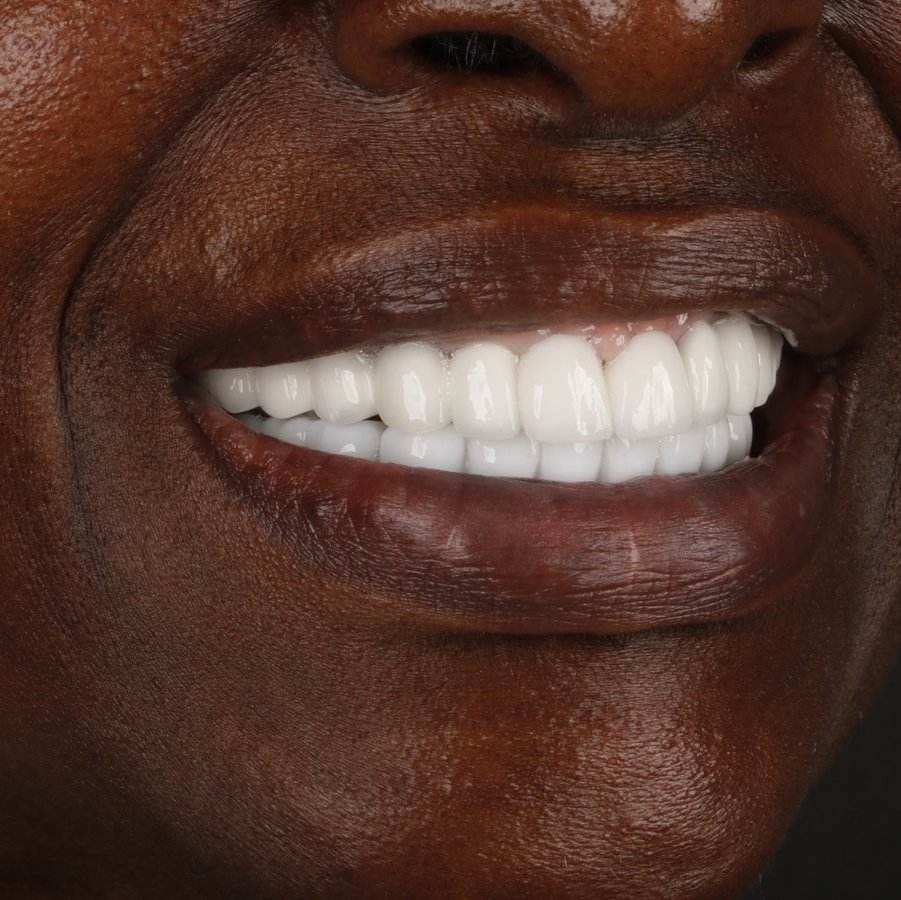 Umut Antalya Oral and Dental Health (DentalClinicAntalya) - Umut Antalya Oral and Dental Health (DentalClinicAntalya)