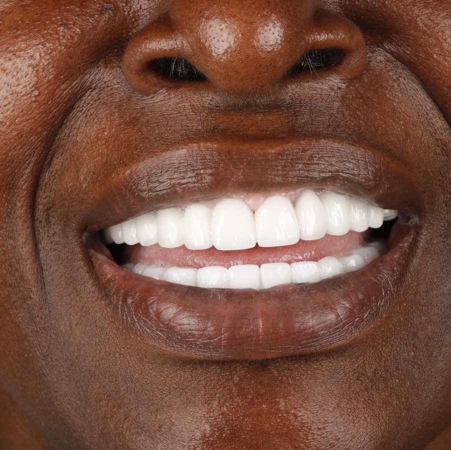 Umut Antalya Oral and Dental Health (DentalClinicAntalya) - Umut Antalya Oral and Dental Health (DentalClinicAntalya)