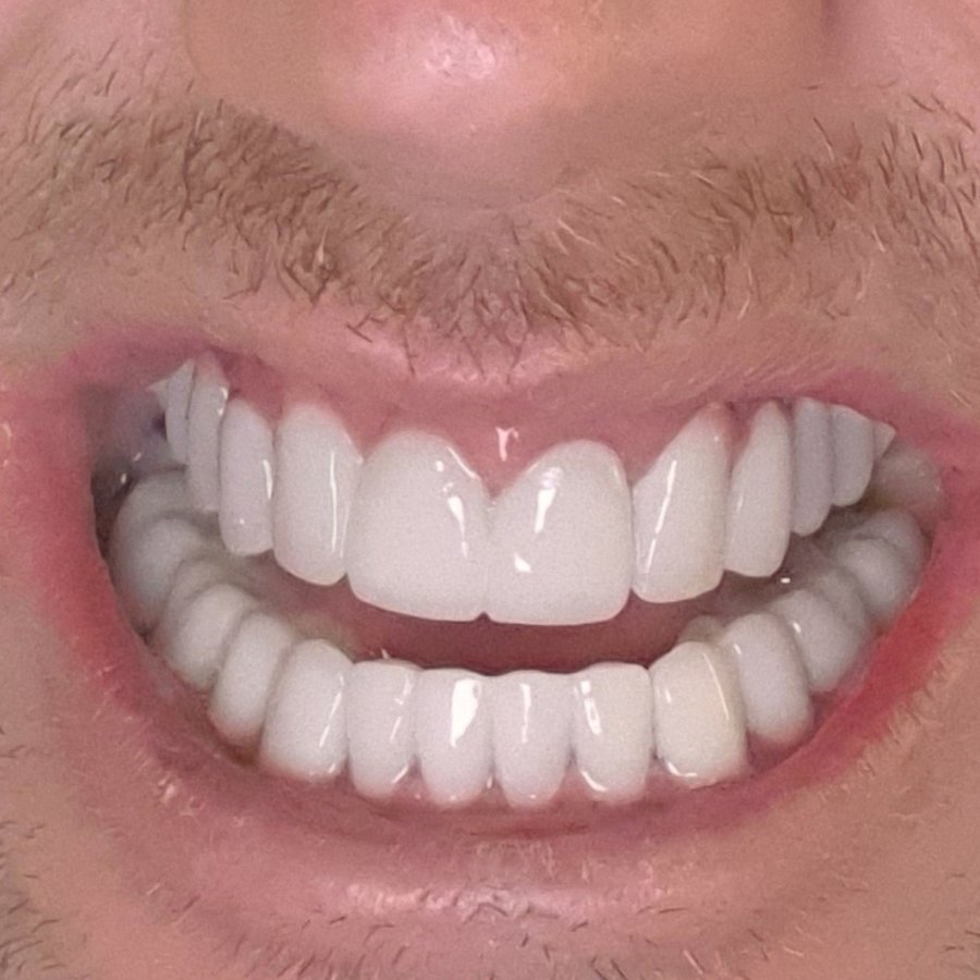 Umut Antalya Oral and Dental Health (DentalClinicAntalya) - Umut Antalya Oral and Dental Health (DentalClinicAntalya)