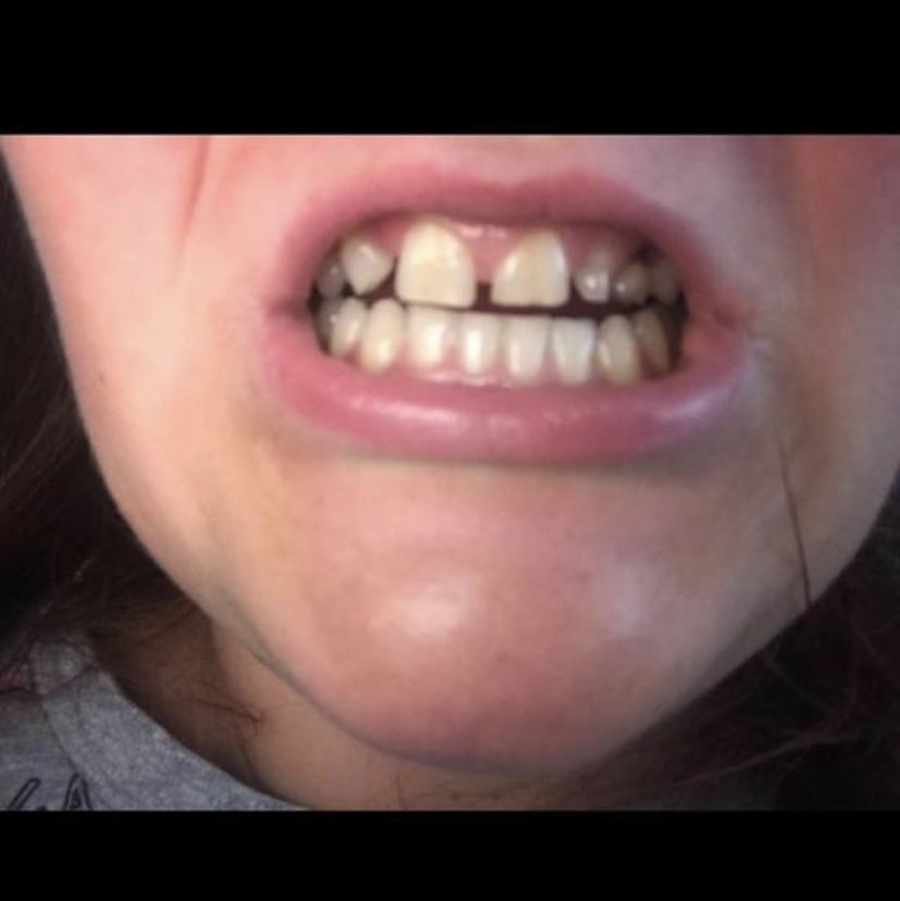 Umut Antalya Oral and Dental Health (DentalClinicAntalya) - Umut Antalya Oral and Dental Health (DentalClinicAntalya)