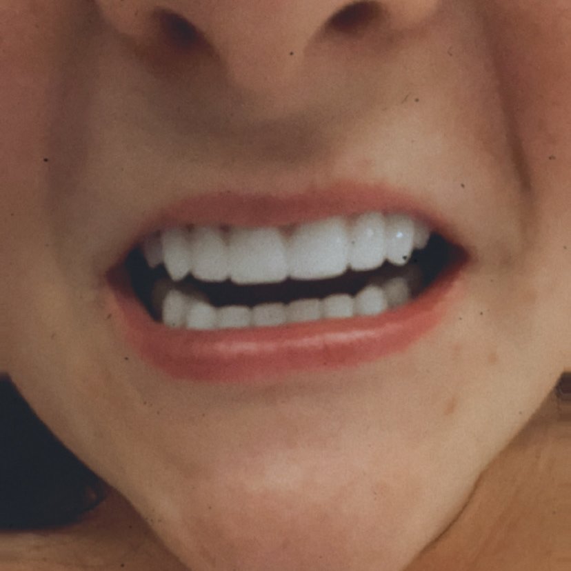 Umut Antalya Oral and Dental Health (DentalClinicAntalya) - Umut Antalya Oral and Dental Health (DentalClinicAntalya)