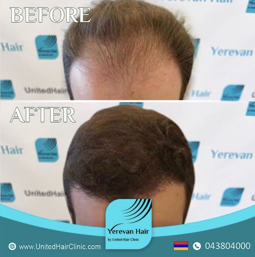 United Hair Clinic - United Hair Clinic