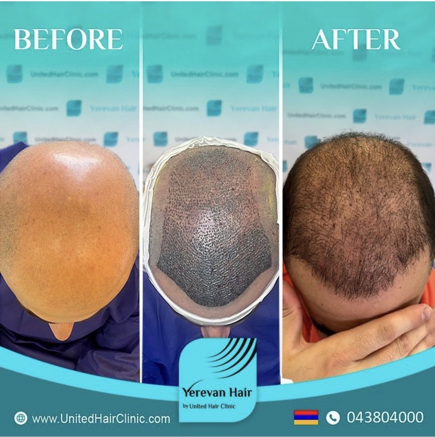 United Hair Clinic - United Hair Clinic