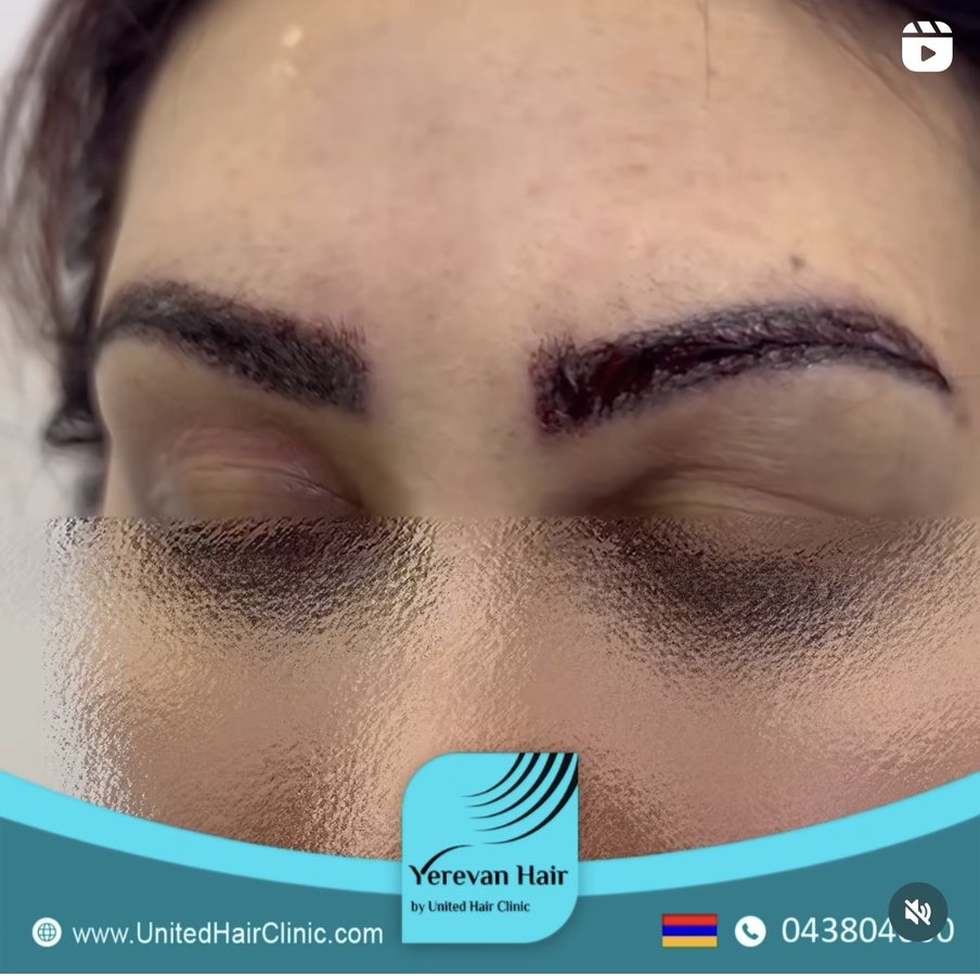 United Hair Clinic - United Hair Clinic