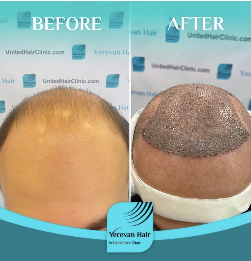 United Hair Clinic - United Hair Clinic