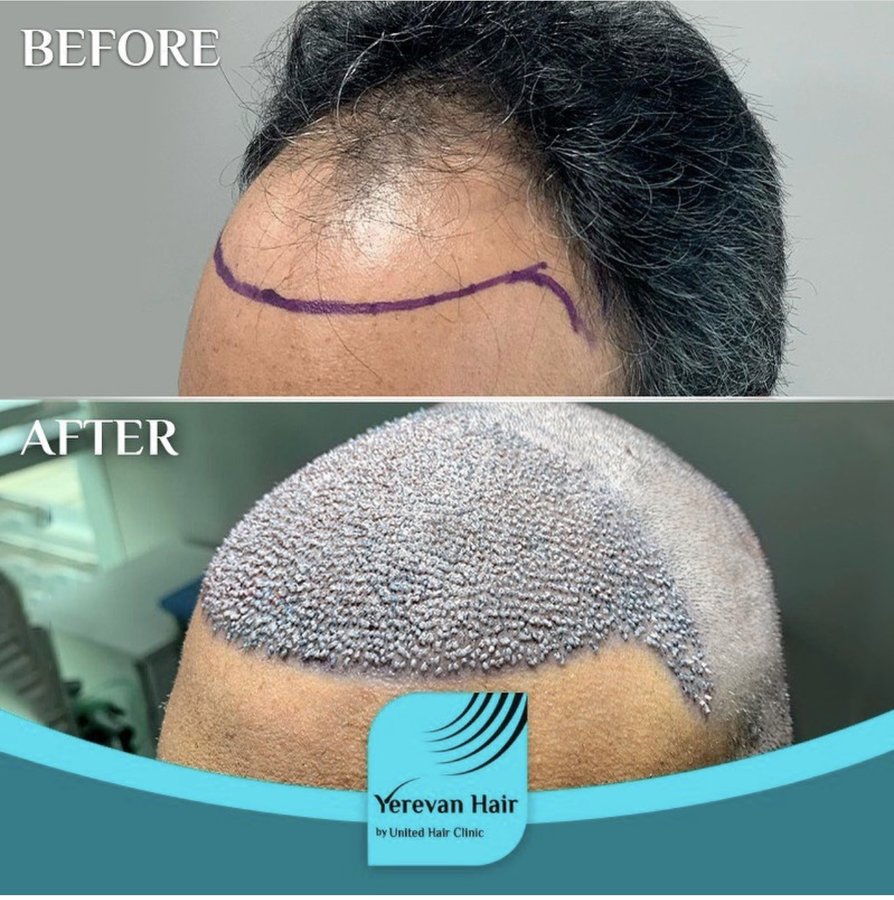 United Hair Clinic - United Hair Clinic