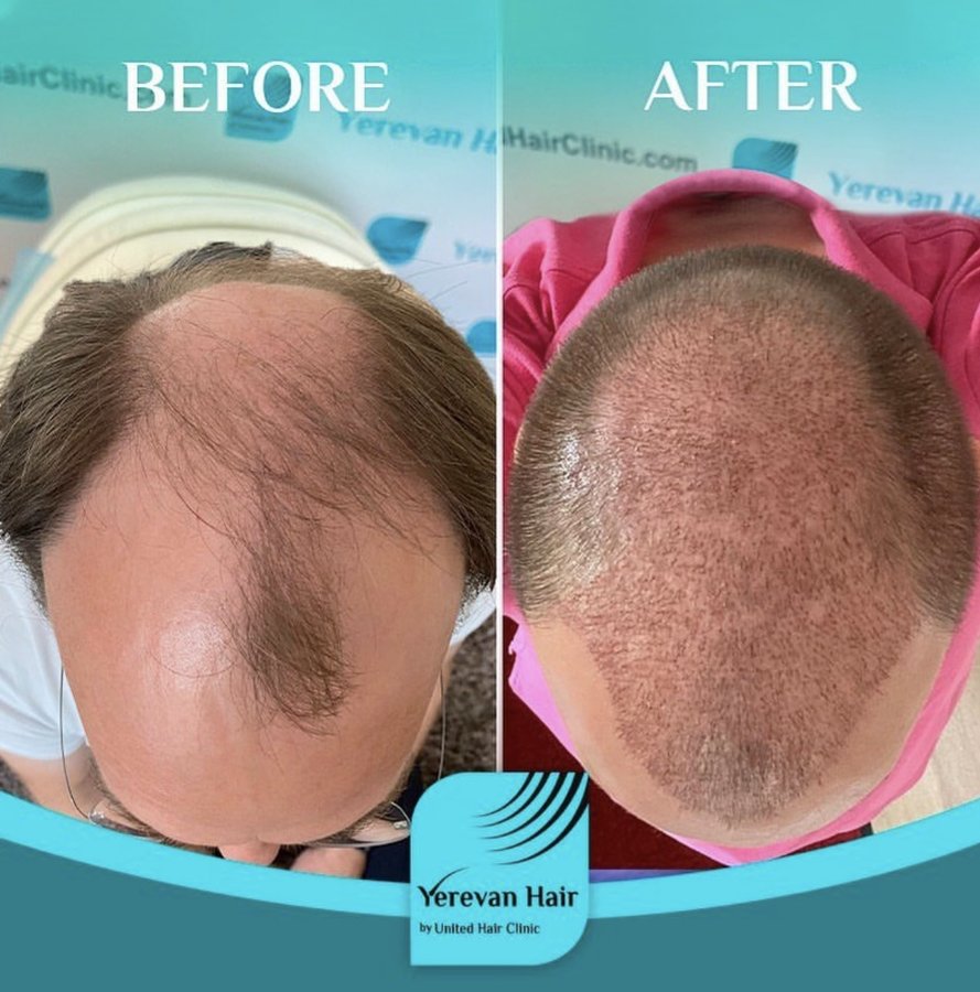 United Hair Clinic - United Hair Clinic