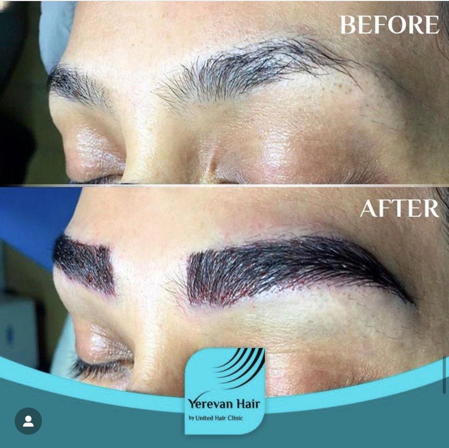 United Hair Clinic - United Hair Clinic