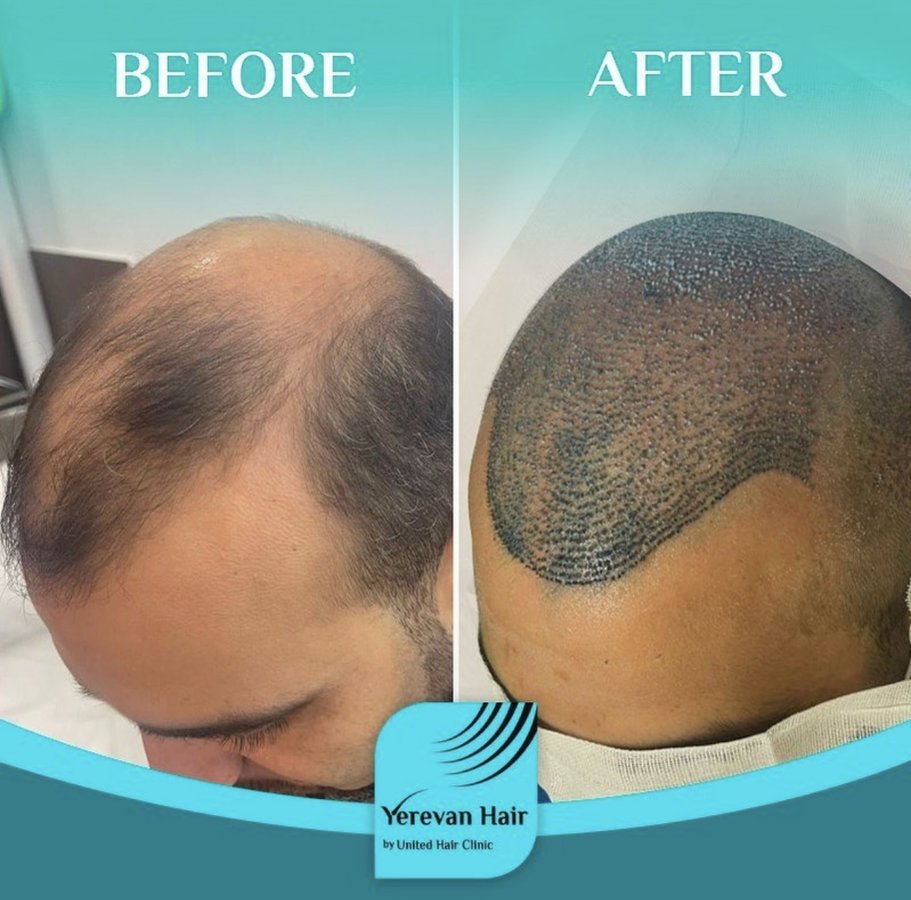 United Hair Clinic - United Hair Clinic