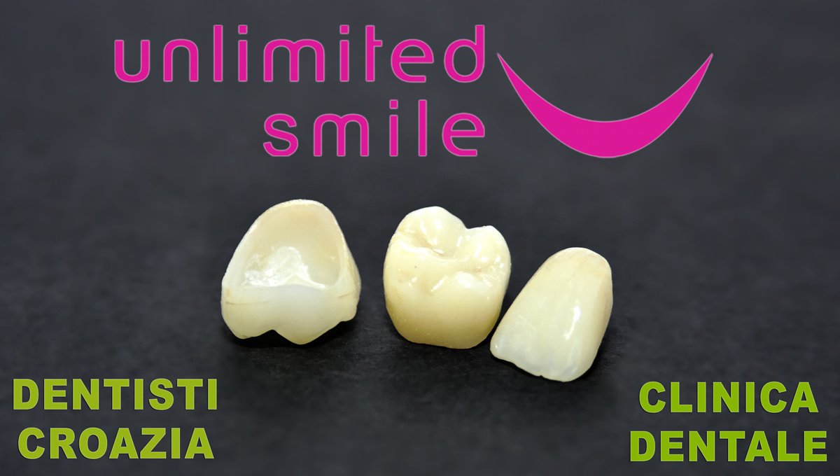 Unlimited Smile - Croazia Dentista - Unlimited Smile - Croazia Dentista