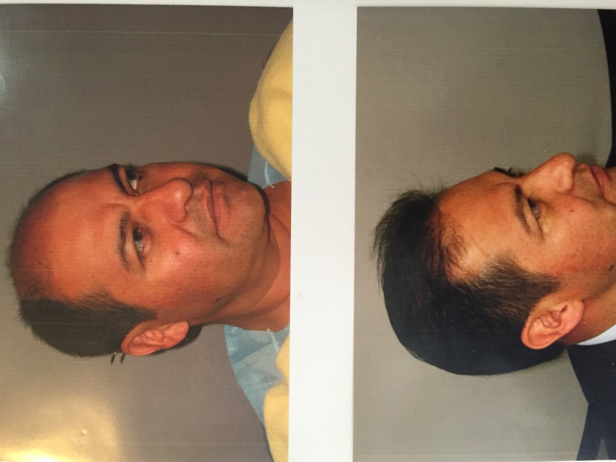 Uranga Hair Center - Uranga Hair Center