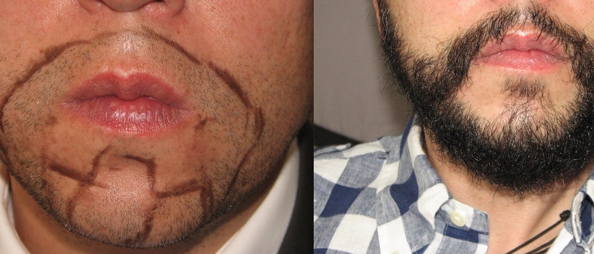 Uranga Hair Center - Uranga Hair Center