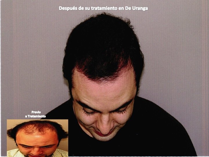 Uranga Hair Center - Uranga Hair Center